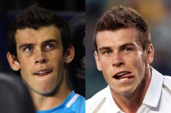 Futbolistas que se han hecho cirugía estética para verse mejor