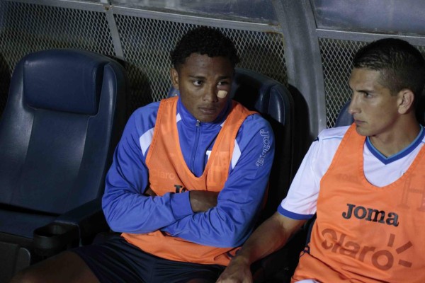 FOTOS: Las curiosidades que dejó el amistoso entre Honduras y Guatemala