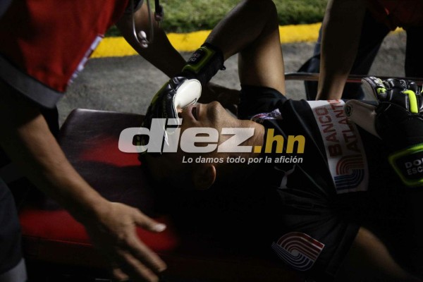 ¡QUÉ DRAMÁTICO! La espeluznante lesión de Donis Escober