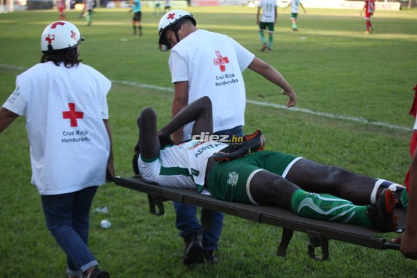 No viste en TV: Increíble parecido y la rabieta de Wilmer Cruz en el Nacional