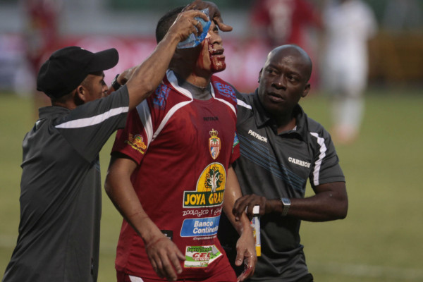 El controversial regreso de Rambo a Tegucigalpa