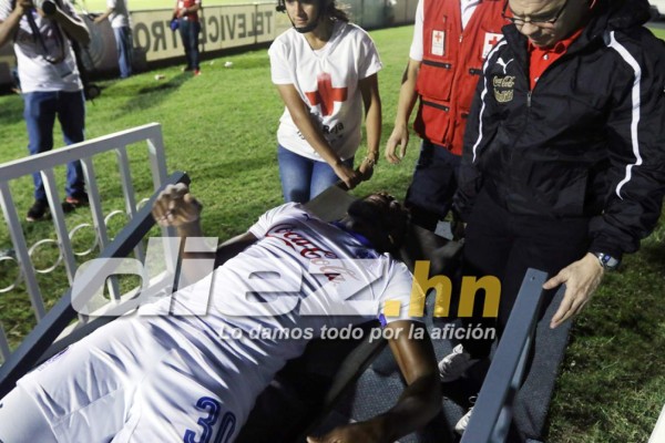 Las imágenes que la televisión no mostró de la jornada 17 en Honduras