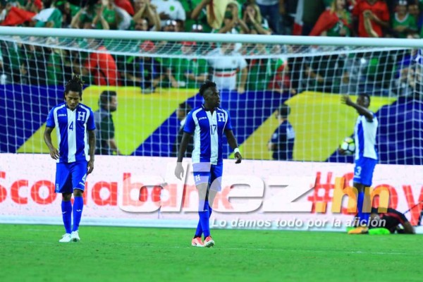 LO QUE NO SE VIO: El barbón, el espontáneo y el sufrimiento de Honduras