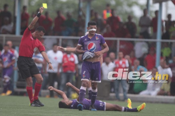¡Belleza, júbilo y llanto! Las imágenes curiosas de las semifinales del Ascenso