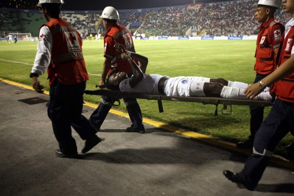 Las imágenes que no se vieron por TV del clásico Motagua-Olimpia