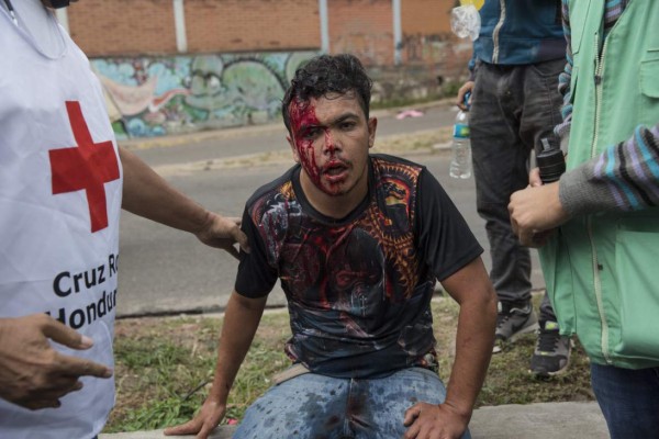 INFORME ESPECIAL: Saqueos de tiendas y caos en las protestas en Honduras