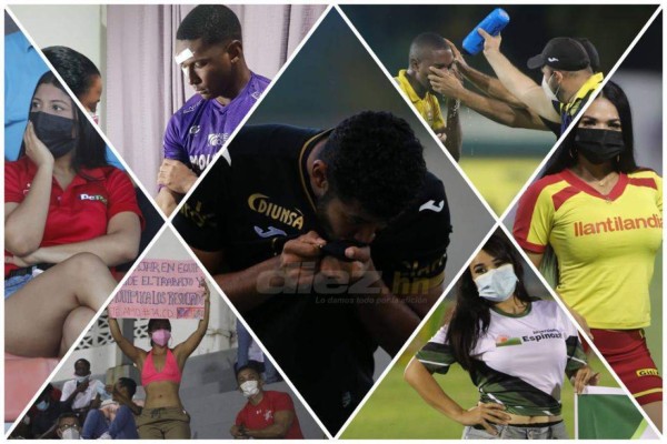 Lo que no viste en TV en la jornada 9: bellezas, beso apasionado de Pereira ¡y graves heridas a dos jugadores!