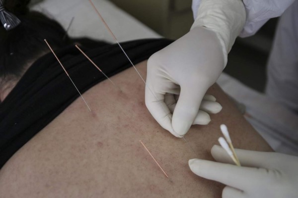 Las técnicas ancestrales que utilizan los médicos chinos para eliminar el coronavirus