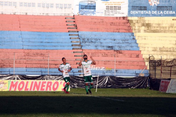 No viste en TV: Increíble parecido y la rabieta de Wilmer Cruz en el Nacional