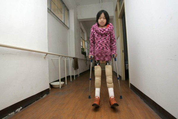 REPORTAJE: La increíble historia de una niña china, sin piernas y campeona de natación