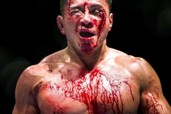 Fotos: Los golpes más espeluznantes en la UFC