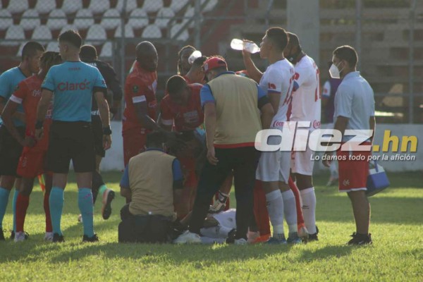 Fotos: La bronca de Obed con Carlos Pineda y el portero del Real de Minas que jugó de delantero