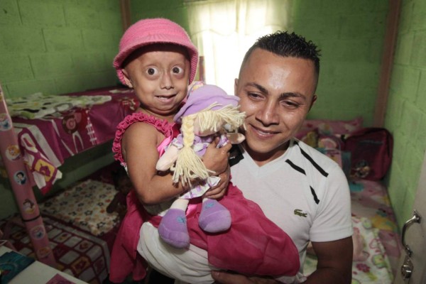 Motagua entrega una casa a niña que sufre de envejecimiento prematuro
