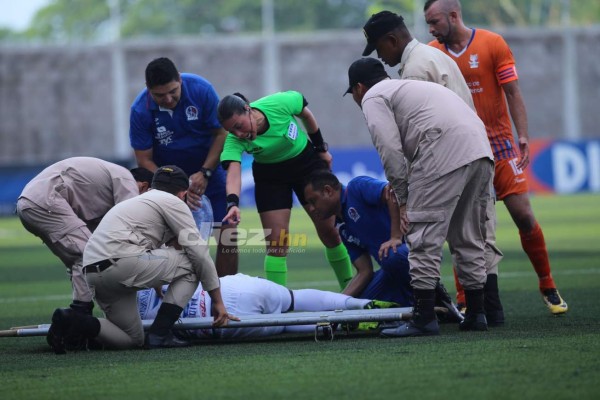 En fotos: La difícil tarde de Pastrana y jugadores de UPNFM terminan abatidos