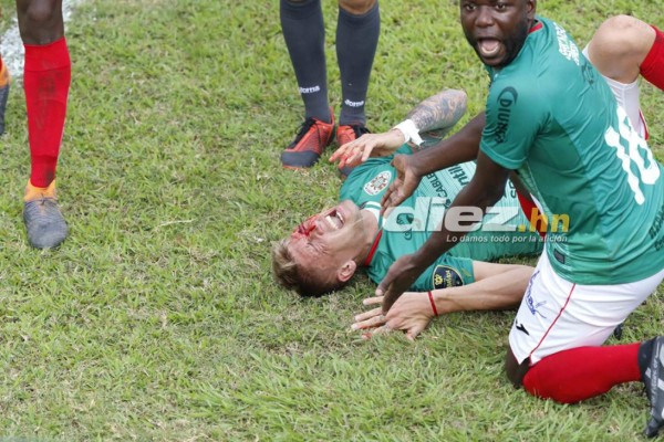 NO VISTE EN TV: El amor de un juvenil al escudo del Platense, persignación y la herida de Techera