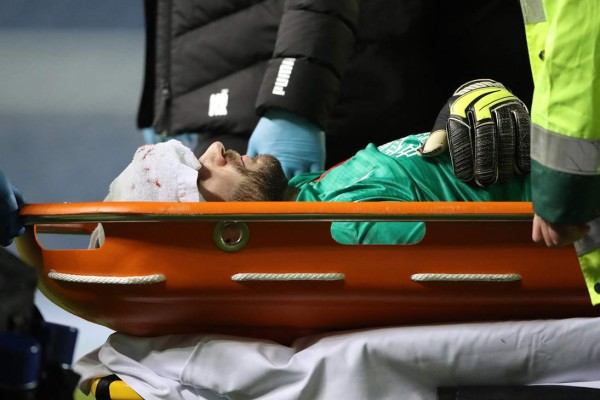 ¡Brutal patada en la Europa League! Delantero del Rangers le partió el rostro al portero del Slavia Praga