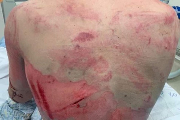 Cara desfigurada y huesos rotos: La paliza que le dieron a un soldado tras ser secuestrado en una cita de Tinder