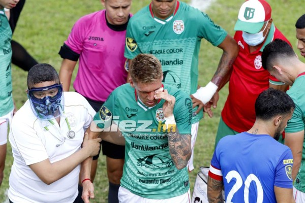 NO VISTE EN TV: El amor de un juvenil al escudo del Platense, persignación y la herida de Techera