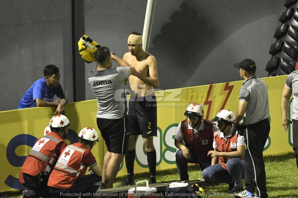 NO SE VIO: Bebé en camino, bengalas y peleas en el Real España-Motagua