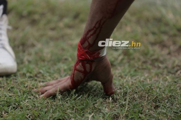 NO VISTE EN TV: Sangre, lágrimas y festejos en la vuelta del repechaje en el Yankel