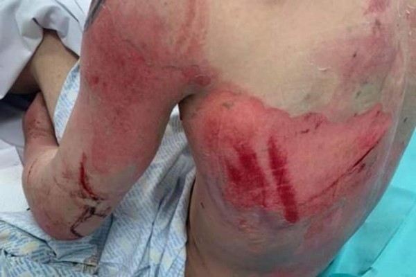 Cara desfigurada y huesos rotos: La paliza que le dieron a un soldado tras ser secuestrado en una cita de Tinder