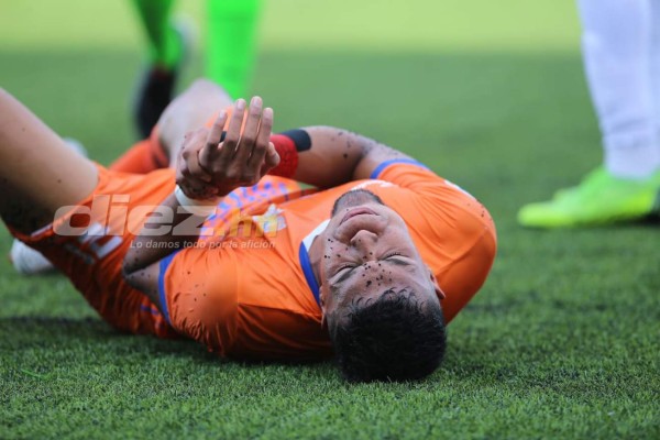 En fotos: La difícil tarde de Pastrana y jugadores de UPNFM terminan abatidos