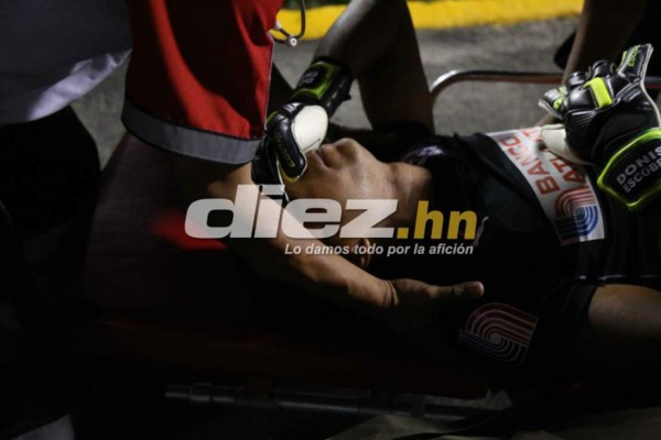 FOTOS: Las lesiones y golpes más dramáticas del fútbol hondureño