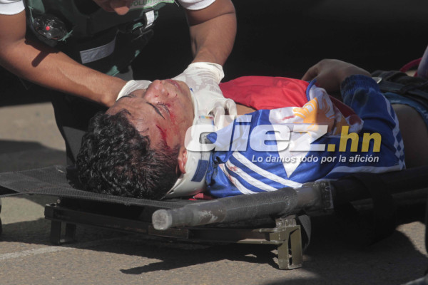 Violencia en las gradas empaña clásico capitalino