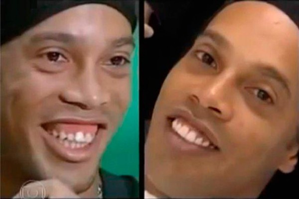 ¡NO ERAN ASÍ! Las figuras que tuvieron que pasar por una cirugía para mejorar su apariencia