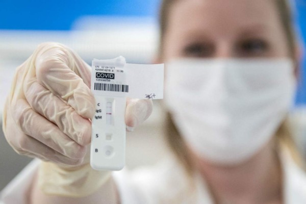 Incómodo y algo molesto: Así son las pruebas para detectar el coronavirus