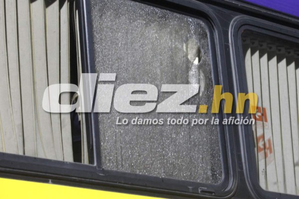 FOTOS: El cobarde ataque al Alianza de El Salvador en Tegucigalpa