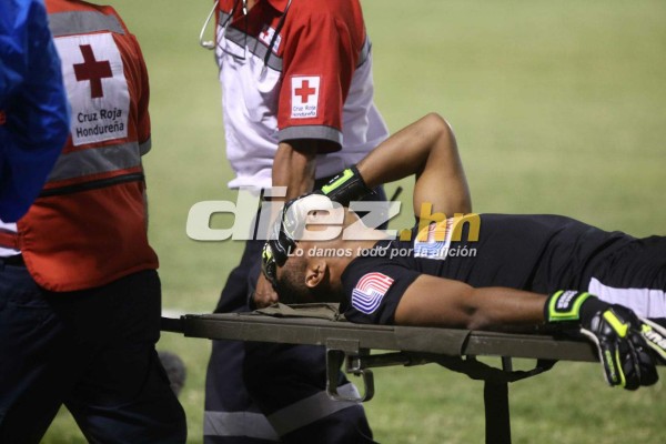 ¡QUÉ DRAMÁTICO! La espeluznante lesión de Donis Escober