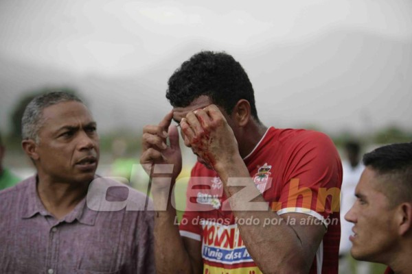 Sangre, abejas, chicas lindas y besos en las fotos curiosas de la fecha 7&nbsp;&nbsp;