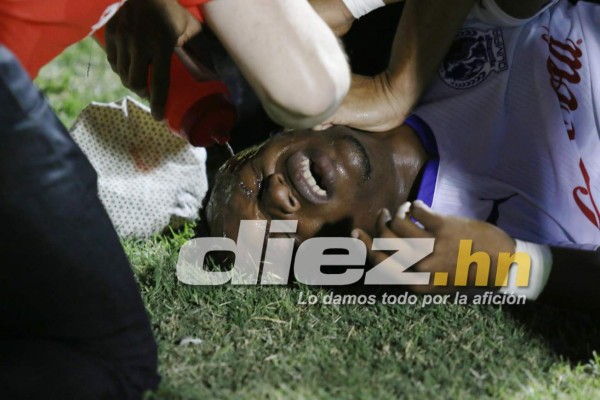 FOTOS: Semifinales de patadas, gritos, insultos y golpes en Honduras