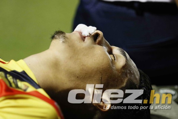 CURIOSAS: El 'nocaut' a Allans Vargas y el agarrón de pelo de César Oseguera a Yeer