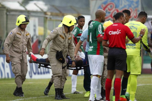 FOTOS: Así le quedó el rostro a Eddie Hernández tras el terrible golpe