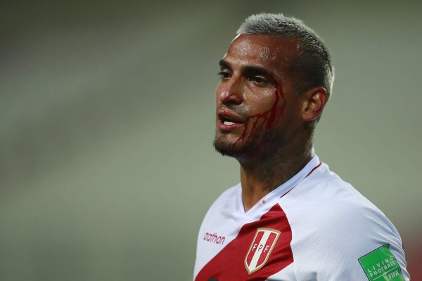 Fotos del Perú - Brasil: Las patadas a Neymar y la sangre de Miguel Trauco