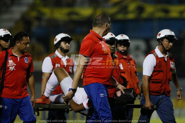 NO SE VIO: El origen del caos, las mantas, gas lacrimógeno y abrazos del clásico