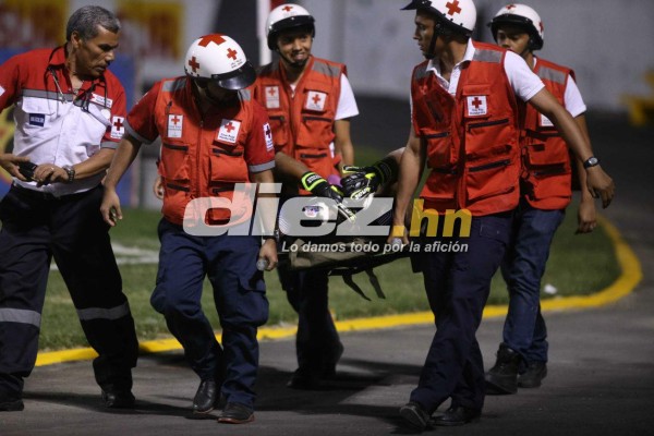 ¡QUÉ DRAMÁTICO! La espeluznante lesión de Donis Escober