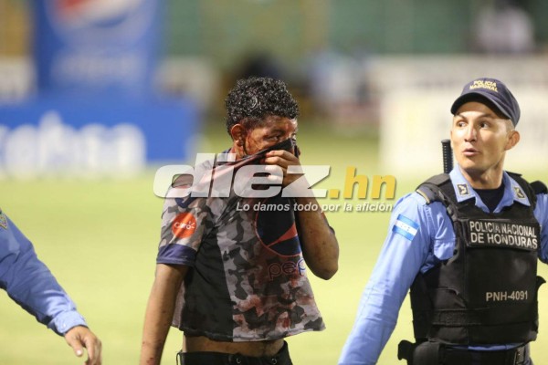 FOTOS: Pleito, colorido, sangre y todo lo que no viste por la TV de las semifinales