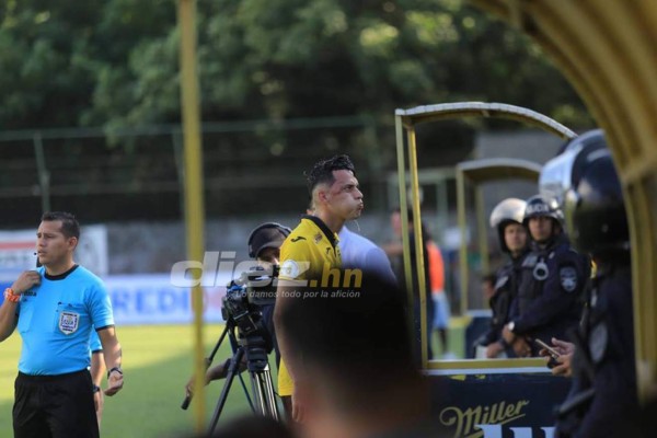 EN FOTOS: Ángel Tejeda perdió el control con gesto obsceno y escupitajo&nbsp;&nbsp;