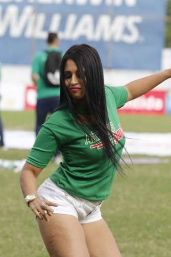 ¡Qué encantadoras! Las bellezas de la jornada 11 de la Liga Nacional