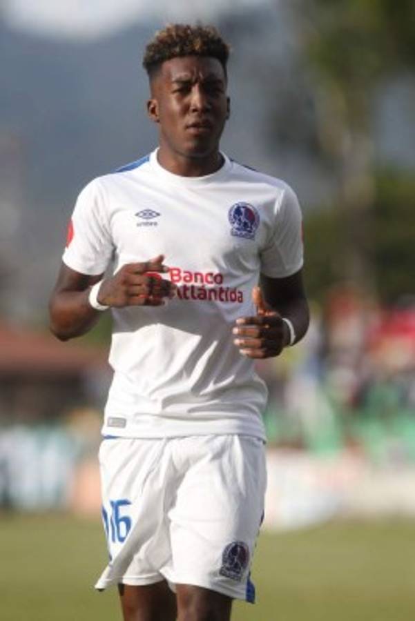 EQUIPAZO: Así es el otro once alternativo que tiene el Olimpia