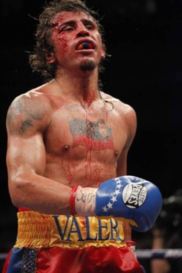 GALERÍA: El suicidio y el deporte siempre han ido de la mano