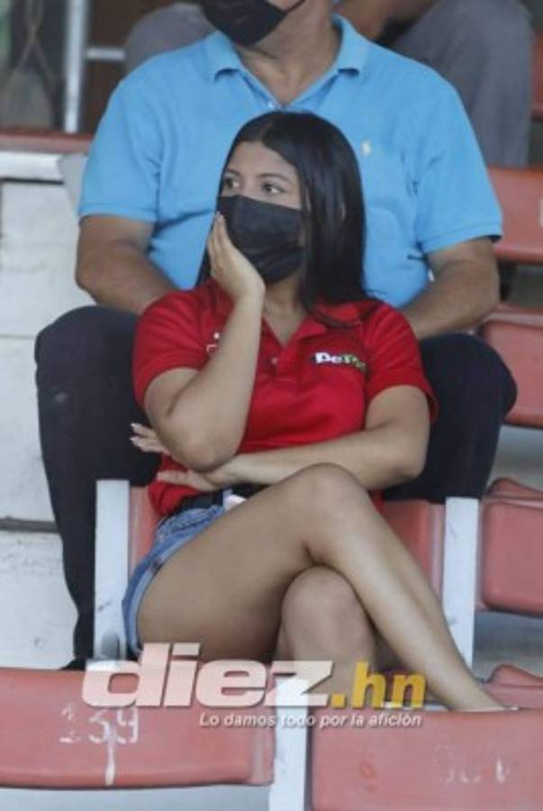 Lo que no viste en TV en la jornada 9: bellezas, beso apasionado de Pereira ¡y graves heridas a dos jugadores!