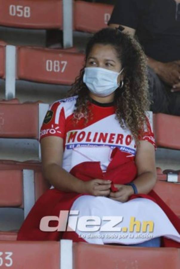 Lo que no viste en TV en la jornada 9: bellezas, beso apasionado de Pereira ¡y graves heridas a dos jugadores!