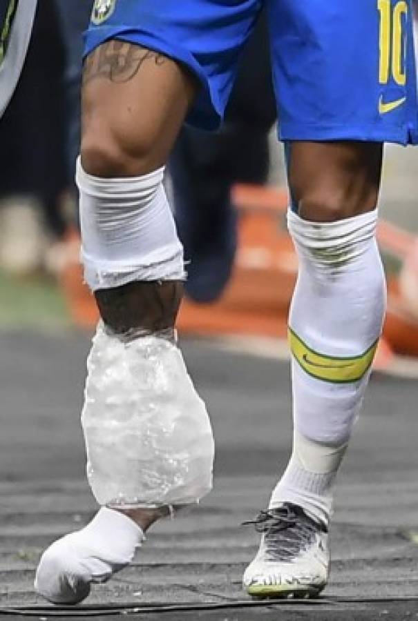 FOTOS: Así fue el drama que vivió Neymar tras su ruptura de ligamentos en el tobillo