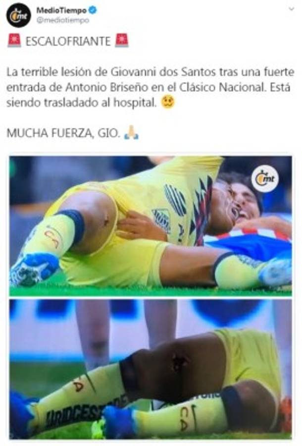 Así reaccionó la prensa mundial tras la grave lesión de Giovanni dos Santos: 'Criminal, de cárcel'