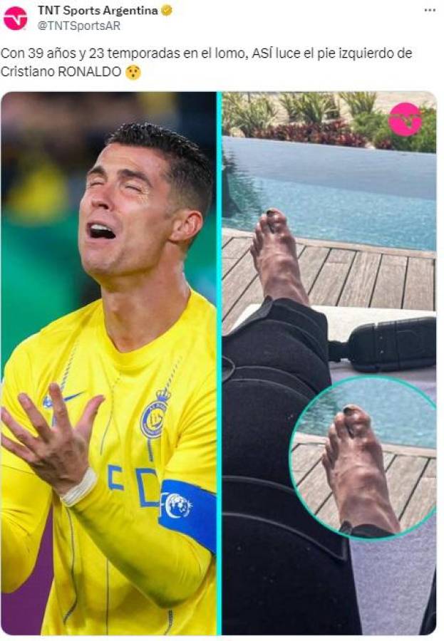 Cristiano Ronaldo muestra sus pies, lo comparan con LeBron James y todos hablan de lo mismo: “Nunca han visto...”