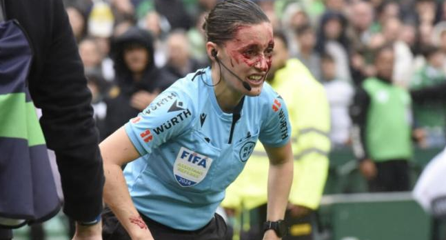 Guadalupe Porras quedó con su rostro ensangrentado tras el impacto con el camarógrafo.